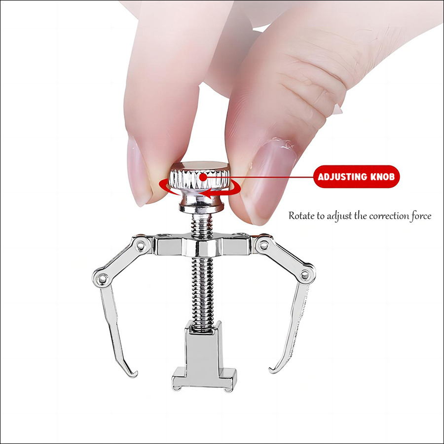 rnt-781 nail orthodontic device