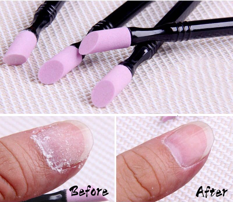 cuticle removal pen